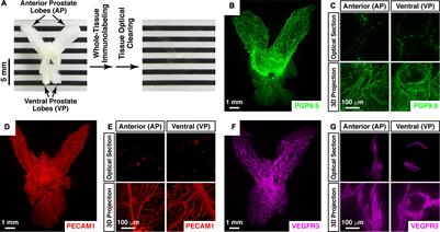 Loss of the Sympathetic Signal Produces Sterile Inflammation of the Prostate